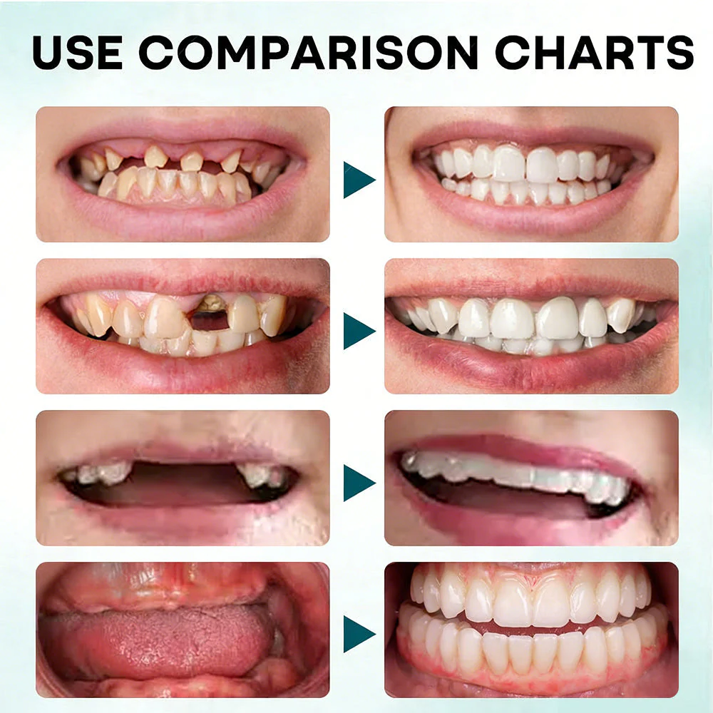NESLEMY DENTURE-LOCK — SECURE YOUR SMILE ALL DAY — 50% OFF - Image 2