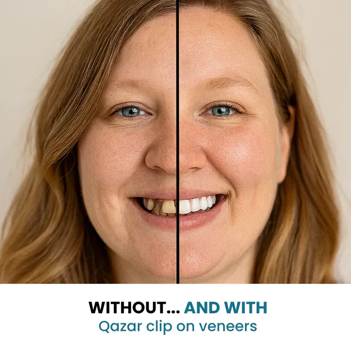 SecureSmile - Achieve a Flawless Smile Instantly - 50% OFF - Image 3