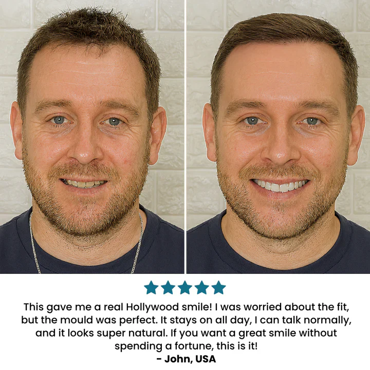 SecureSmile - Achieve a Flawless Smile Instantly - 50% OFF - Image 8