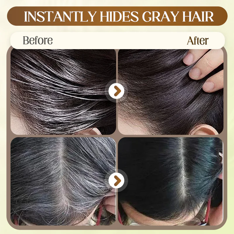 SilverVanish Pro - 10-Year Younger Look Instantly - 50% OFF - Image 2