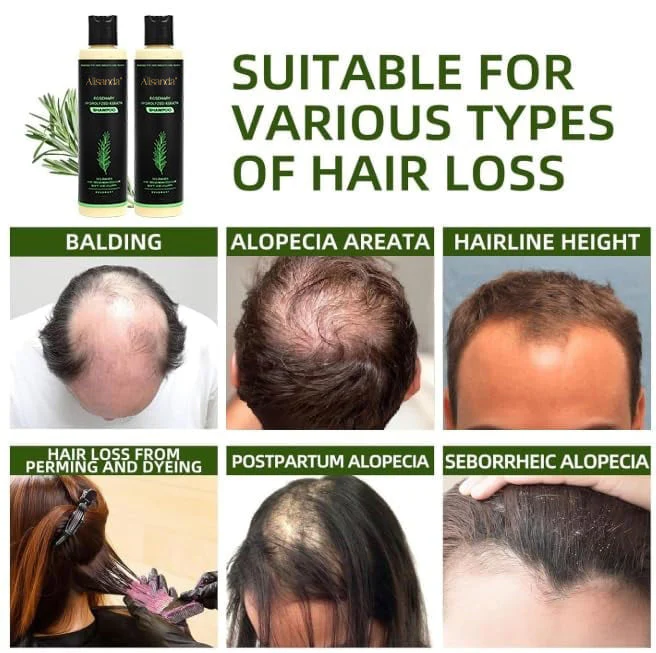 The AuraRoot Rosemary Shampoo - Organic Hair Growth, Hydrolyzed Keratin, and Thickening Formula +  50% OFF - Image 2