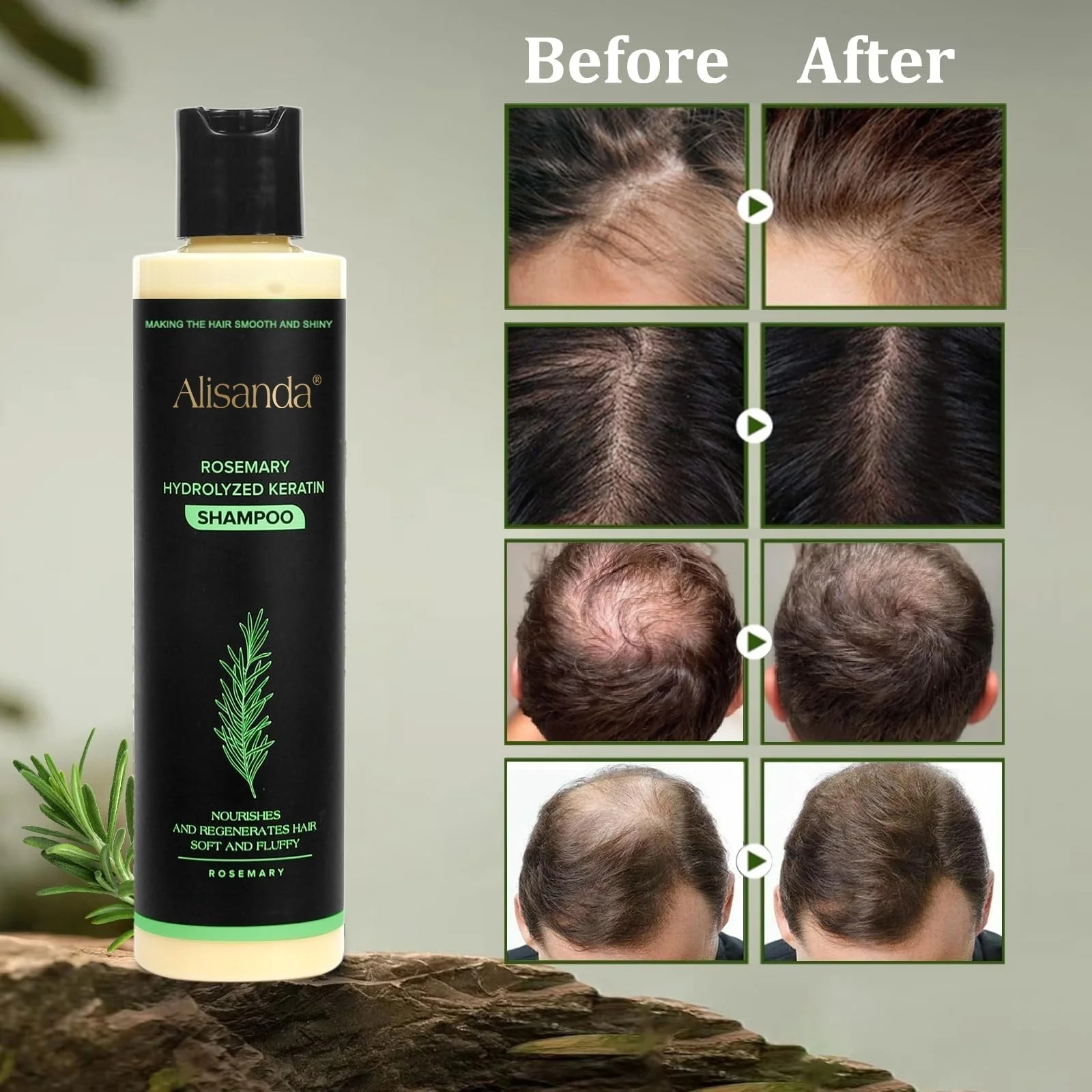 The AuraRoot Rosemary Shampoo - Organic Hair Growth, Hydrolyzed Keratin, and Thickening Formula +  50% OFF - Image 8