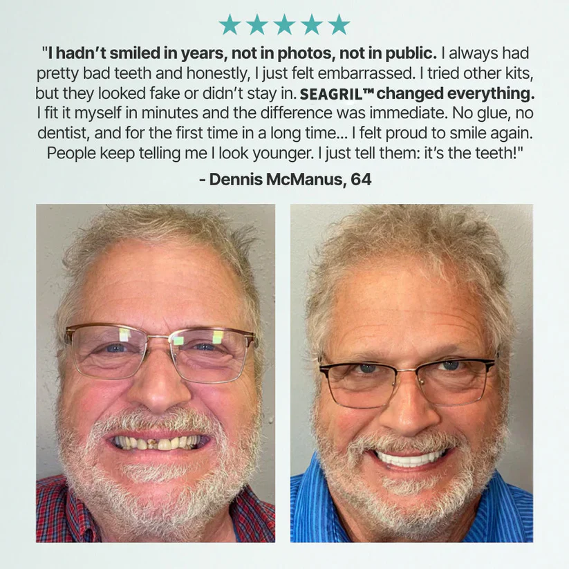 The FlexFit Adaptive Dentures - Custom Fit, Functional, and Natural Look + 50% OFF - Image 11
