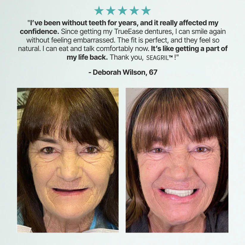 The FlexFit Adaptive Dentures - Custom Fit, Functional, and Natural Look + 50% OFF - Image 2