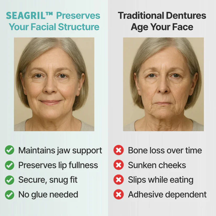 The InstaSmile Custom Dentures - Smile With Confidence Again + ENDS TODAY + 50% OFF - Image 9