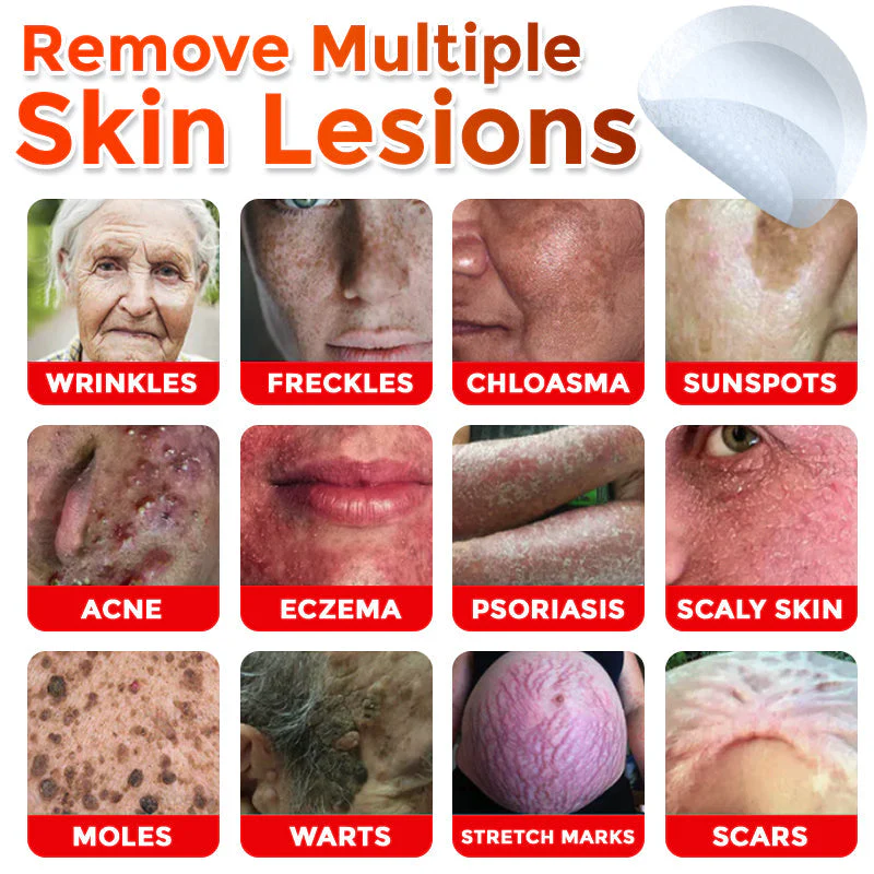 The MicroDerm Patch - Painless Skin Tag & Blemish Removal + 50% OFF - Image 2