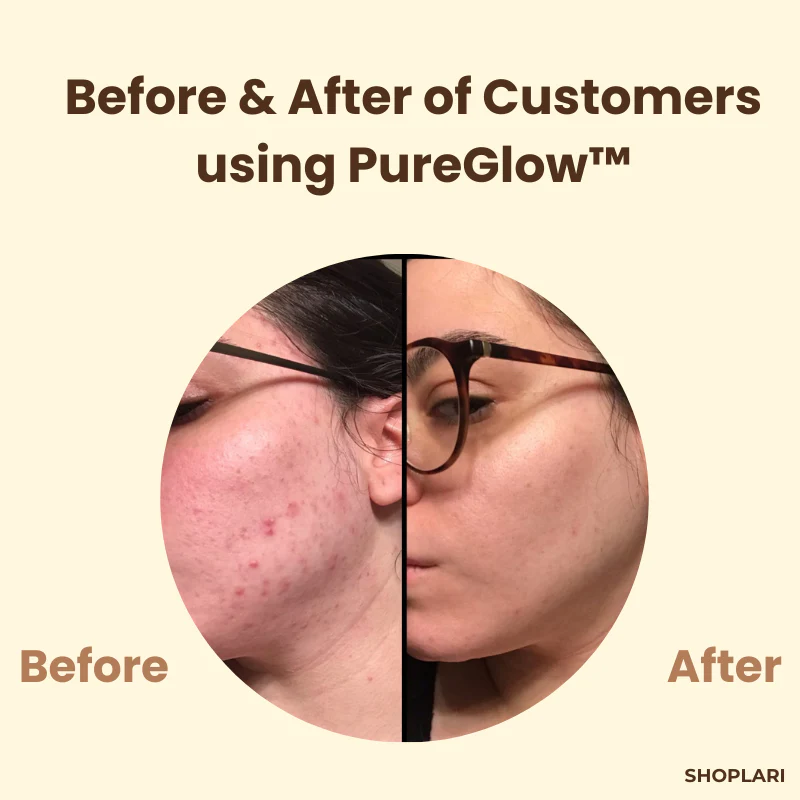 The PureGlow Black Tea Mask - A Total Skin Reset in a Jar + 1+1 FREE - Image 3