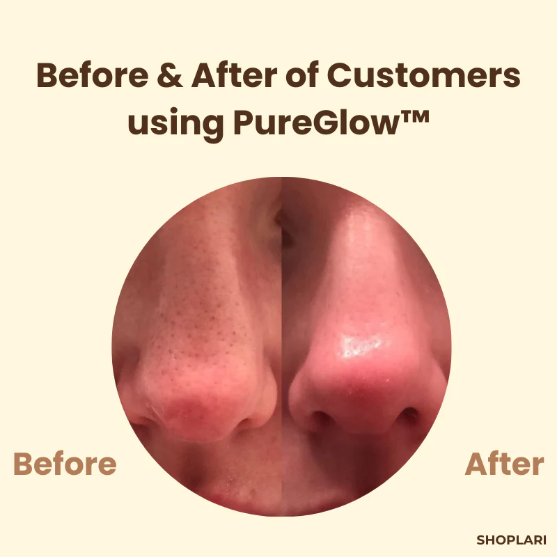 The PureGlow Black Tea Mask - A Total Skin Reset in a Jar + 1+1 FREE - Image 4