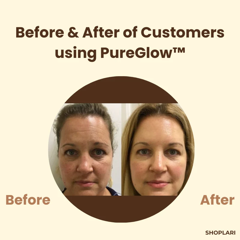 The PureGlow Black Tea Mask - A Total Skin Reset in a Jar + 1+1 FREE - Image 5