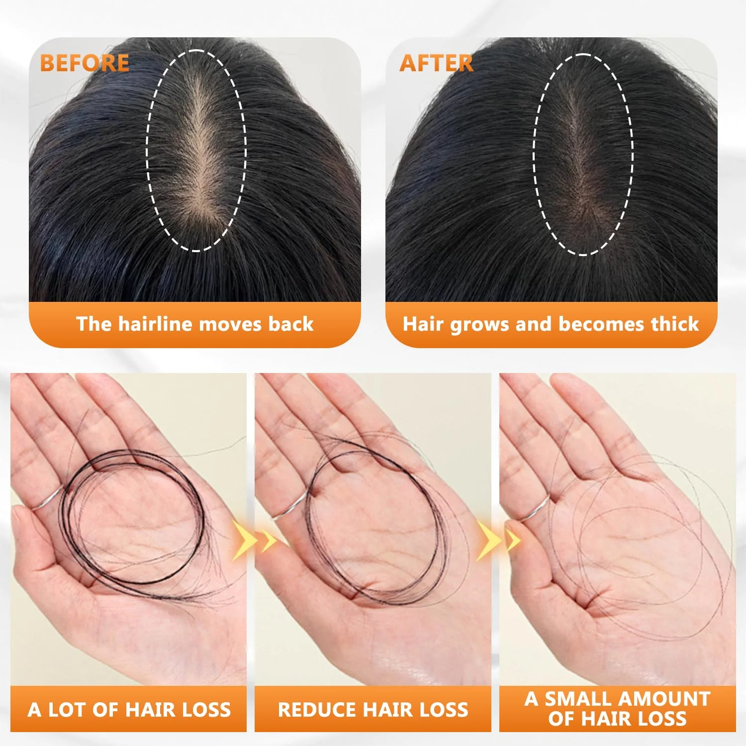 The Root-Strength Shampoo - Thicker Hair, Less Hair Fall + 50% OFF - Image 4